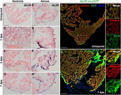Tbx20 Induction Promotes Zebrafish <mark class="highlighted">Heart Regeneration</mark> by Inducing Cardiomyocyte Dedifferentiation and Endocardial Expansion